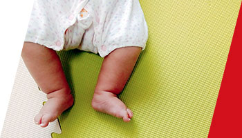 先天性股関節脱臼、側弯症